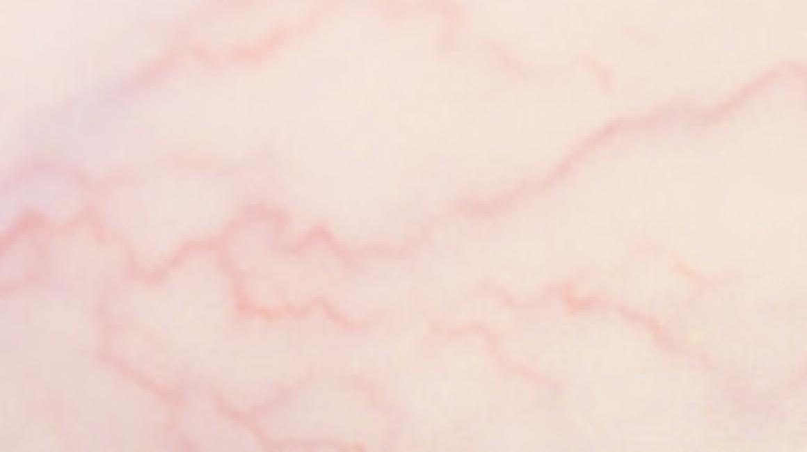 Program Profilaktyki Chorób Kardiologicznych (KORDIAN)