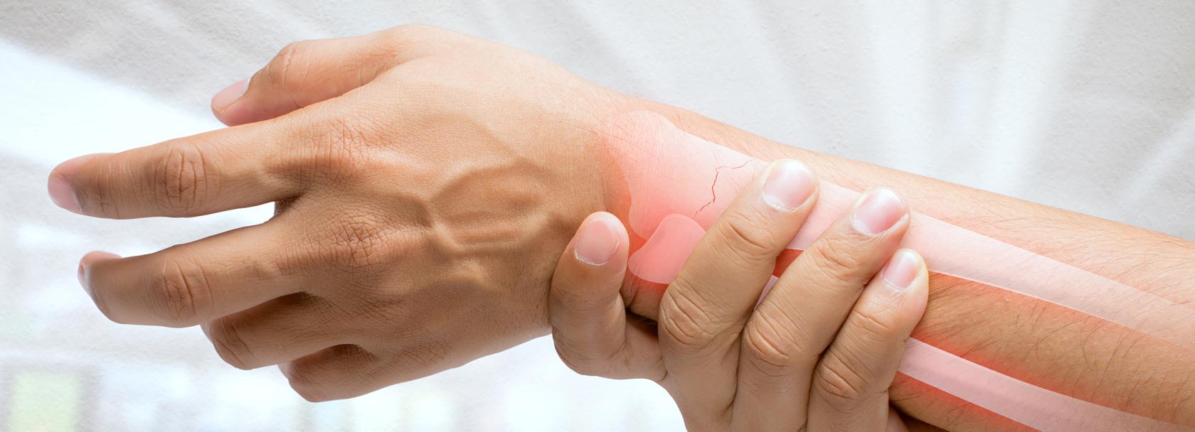 Dłoń w nadgarstku, na przekroju widać złamaną kość