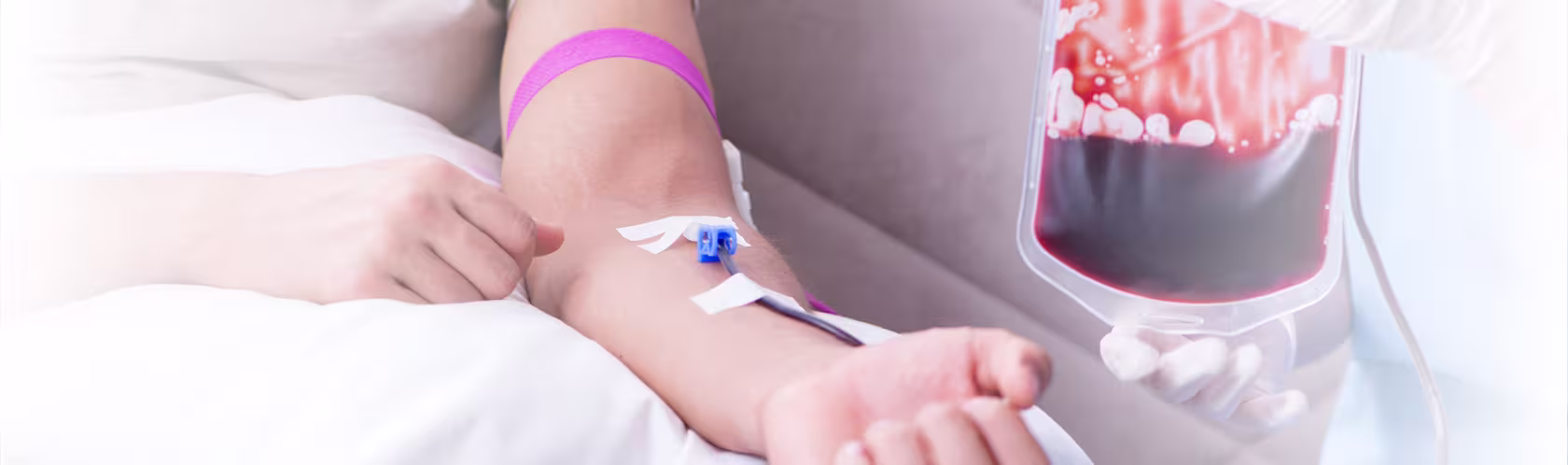 Osoba oddająca krew, z igłą w żyle i krwią spływającą do worka z krwią trzymanego przez personel medyczny. Widoczny tylko tułów osób.